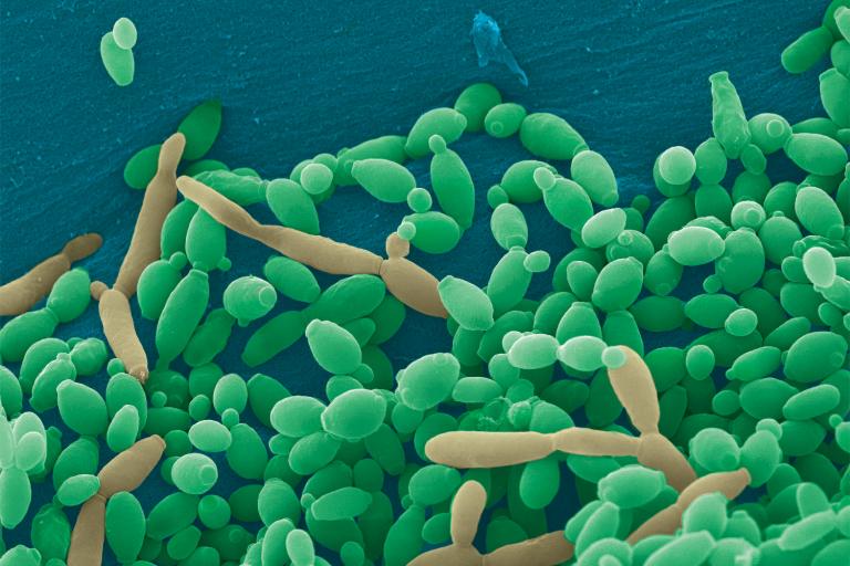 candida tropicalis under a microscope